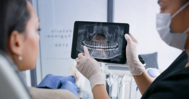 Licensed Root Canal Treatment service in Silver Lake, FL - Dentist Open Now